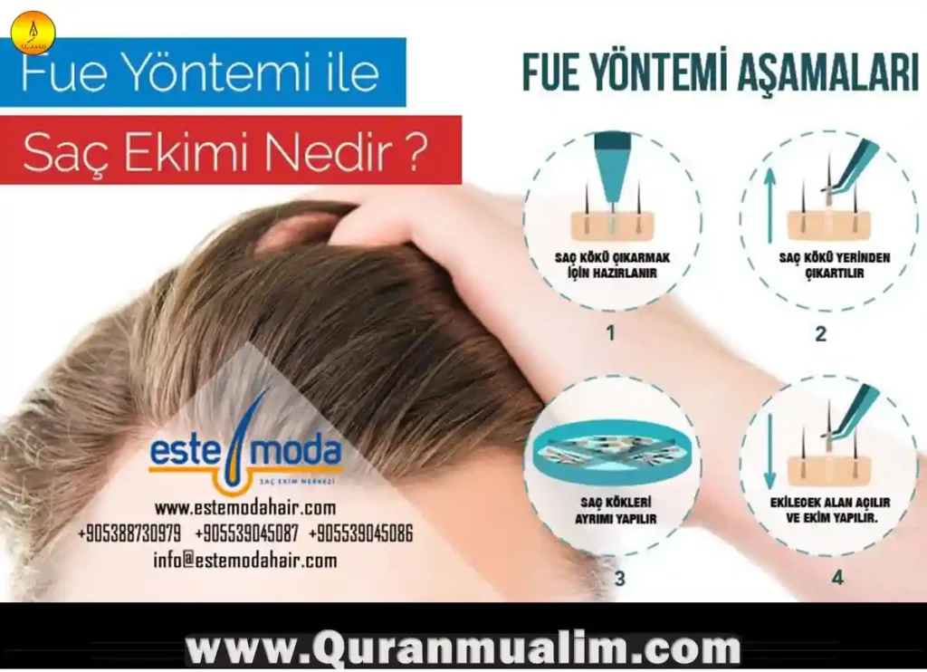 is-hair-transplant-haram-in-islam-quran-mualim